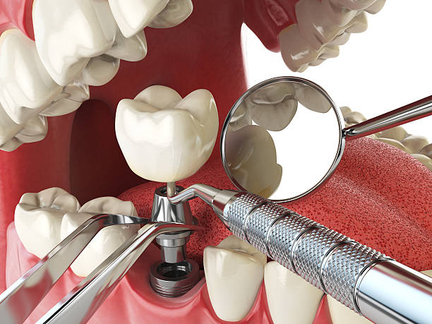 Best Knocked-Out Tooth Emergency  in Scissors, TX